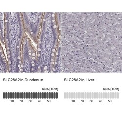 SLC28A2 Antibody, Novus Biologicals 0.1mL; Unlabeled:Antibodies, Polyclonal